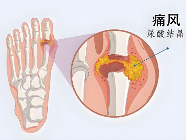 不忌口也降尿酸？国产“绿灯瓶”一夜狂揽七位数是炒作还是真香(图1)