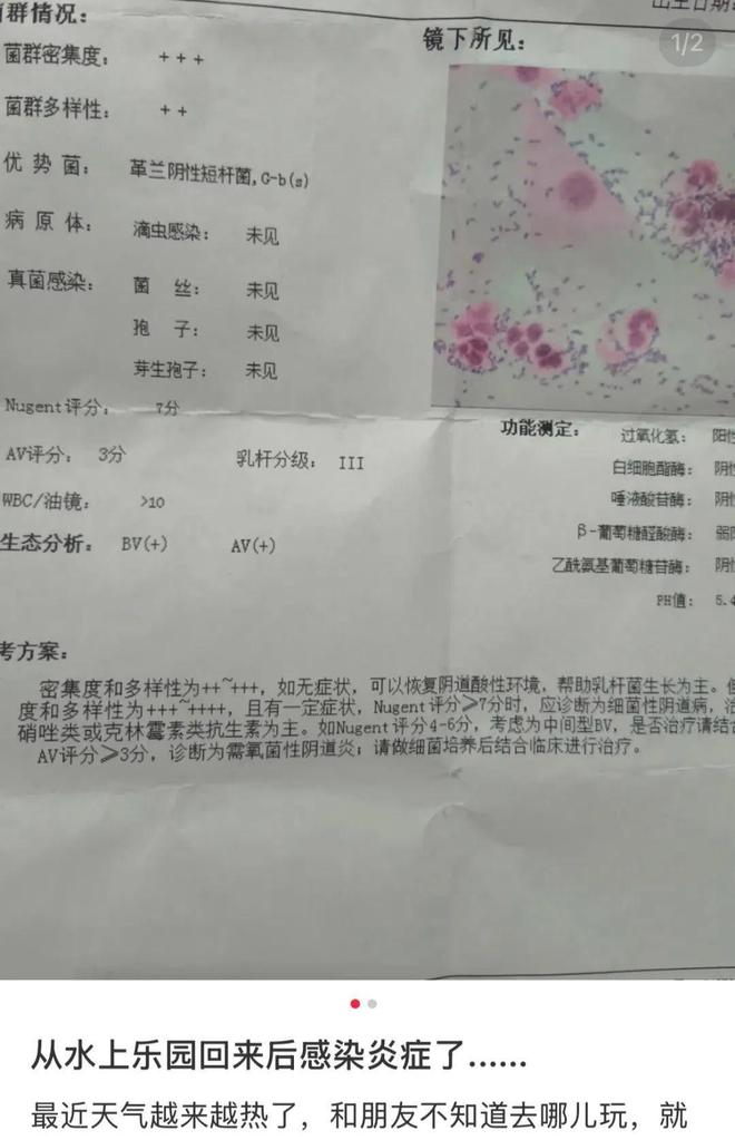 比厕所还脏比砒霜毒！暑假“遛娃”圣地居然藏着妇科病危机？(图2)