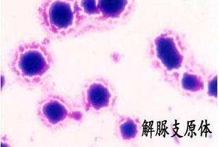 解脲支原体感染中药与西药联合治疗(图1)