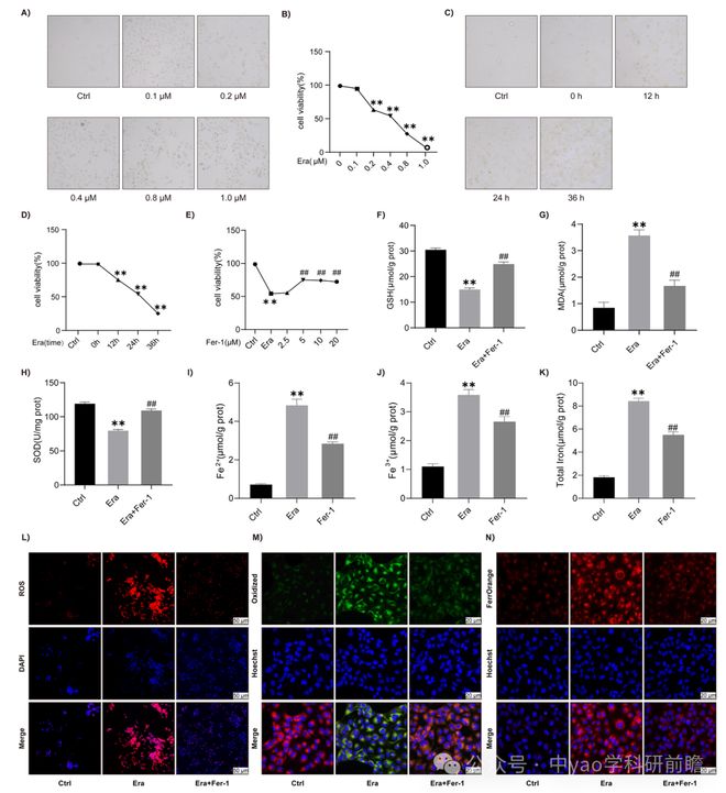 Phytomedicine湖北中医药大学团队揭示大黄甘草汤通过SIRT3介导NRF2去乙酰化抑制急性肾损伤中铁死亡(图3)