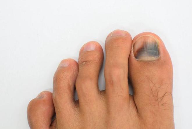 疾病来前脚先知？提醒：快看看你的脚有这5个症状别忽视！(图5)
